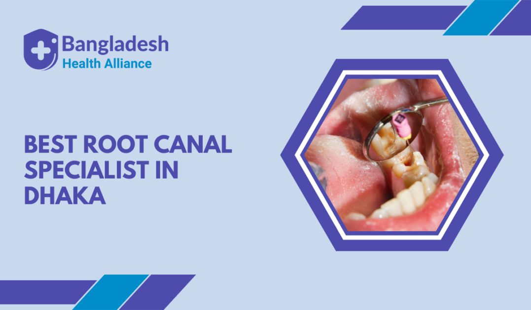 Find the Best Root Canal Specialist in Dhaka BHA