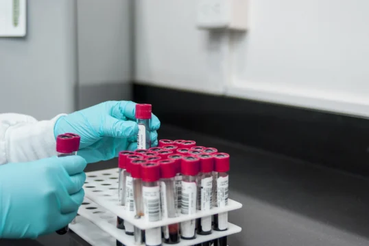 Understanding STD Tests