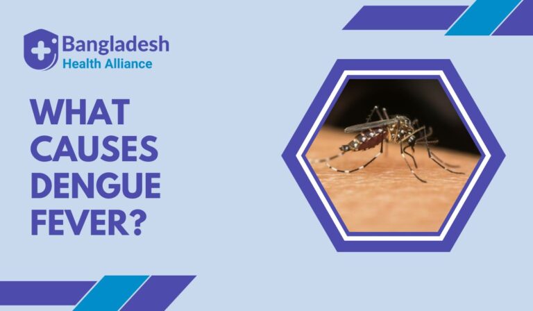 What Causes Dengue Fever?