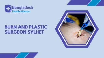 Burn and Plastic Surgeon Sylhet