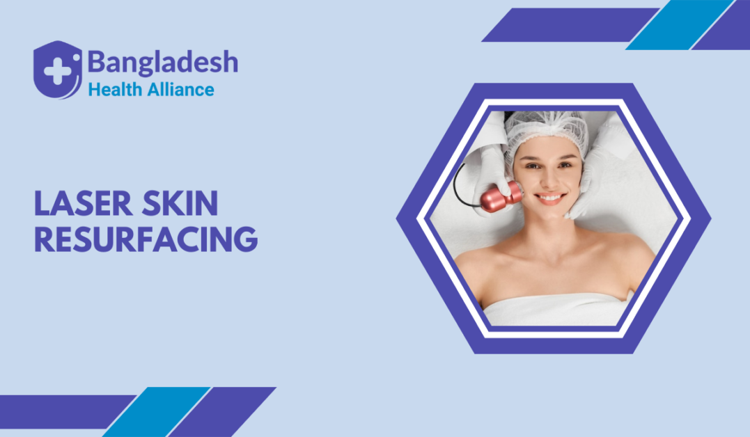 Laser Skin Resurfacing in Bangladesh