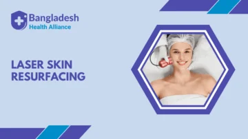 Laser Skin Resurfacing in Bangladesh