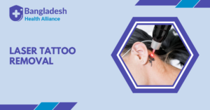 Laser Tattoo Removal in Bangladesh
