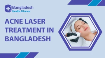 Acne Laser Treatment in Bangladesh