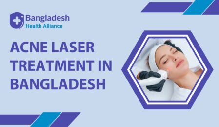 Acne Laser Treatment in Bangladesh