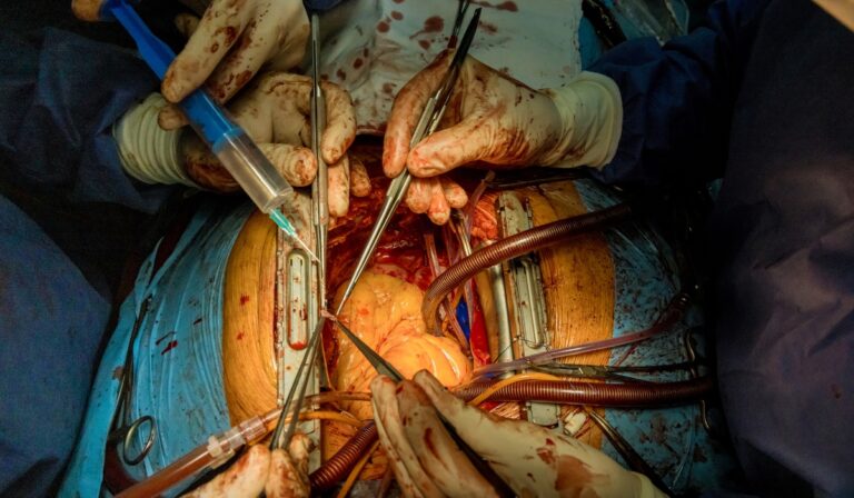 Heart Bypass Surgery Cost in Bangladesh