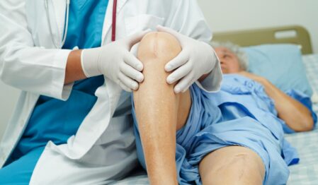 Knee Replacement Surgery Price in Bangladesh