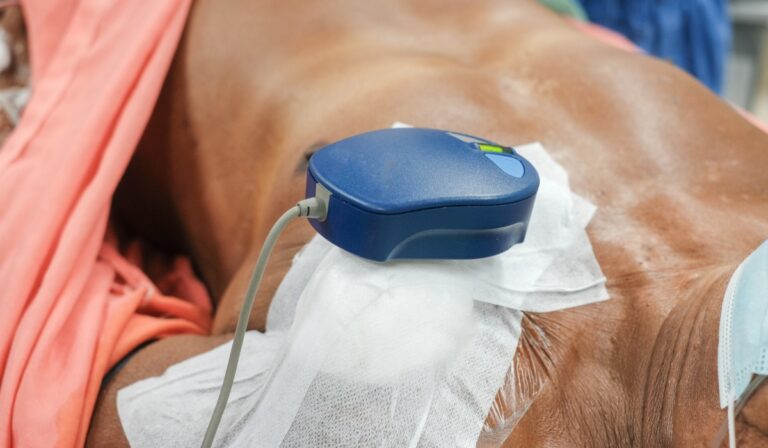 Pacemaker Implantation Price in Bangladesh