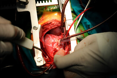 Cardiac Surgery Specialist in Rajshahi