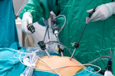 laparoscopic surgery specialists in Rajshahi