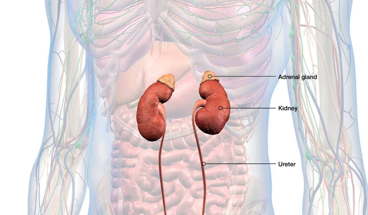 Kidney and Urinary Stone