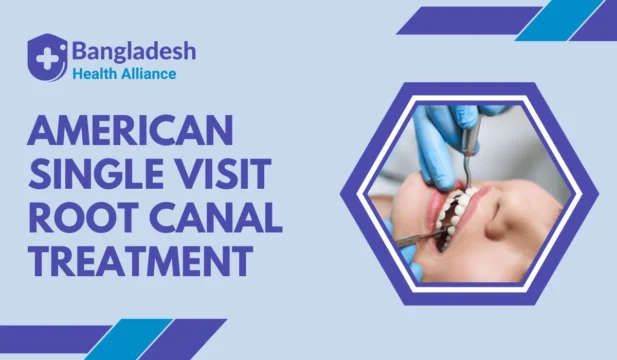 American Single Visit Root Canal Treatment – Expert Care in One Appointment