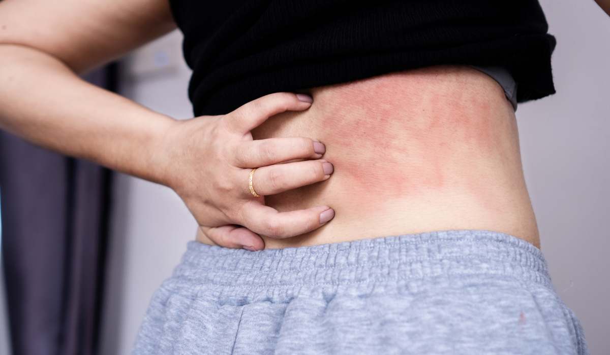 Dermatology (Skin Diseases)