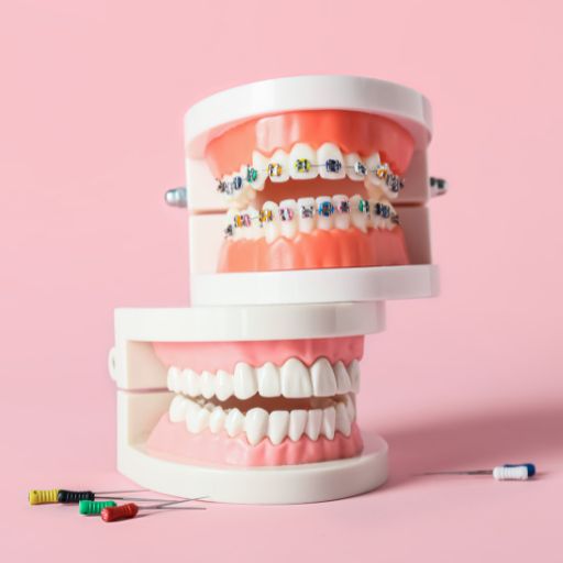 Orthodontics (Braces & Alignment)