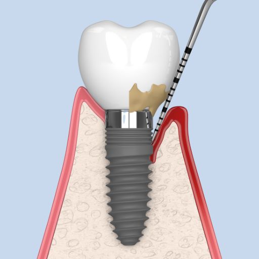 Periodontics & Implantology
