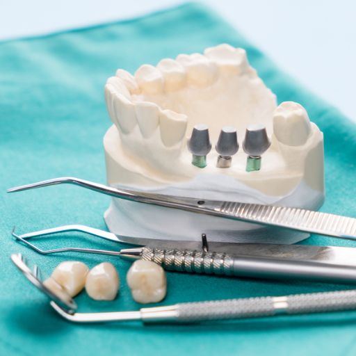 Prosthodontics & Smile Rehabilitation