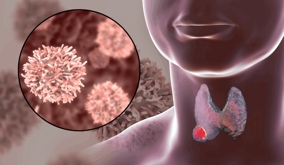 Thyroid profile and hormone level assessments