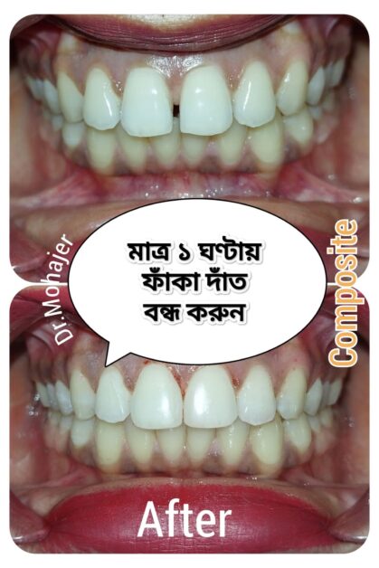 Orthodontics — Braces & Aligners