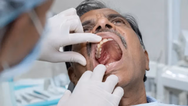 Clinical examination of hard-palate and retromolar cancer inside the upper mouth