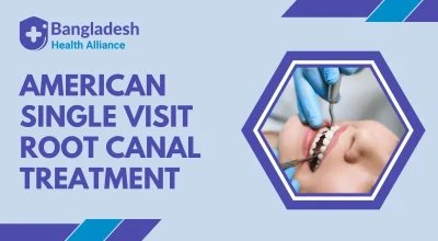 American Single Visit Root Canal Treatment – Expert Care in One Appointment