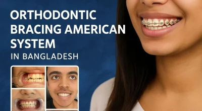 Orthodontic Bracing American System in Bangladesh